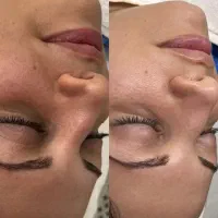 پاکسازی و فیشال تخصصی بانوان با قیمت مناسب در کرج