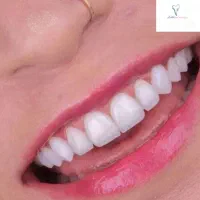 خدمات دندانپزشکی
