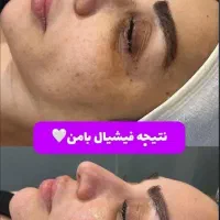 خدمات وآموزش صفر تا صد فشیال و پاکسازی صورت|خدمات آرایشگری و زیبایی|مشهد, دانشجو|دیوار