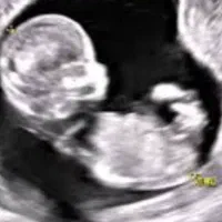 تایپیست و منشی سونوگرافی