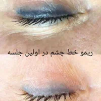 انجام کلیه خدمات آرایش دائم در گلستان|خدمات آرایشگری و زیبایی|گلستان (تهران), |دیوار