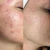 کلینیک زیبایی خدمات فیلر بوتاکس مزوژل PRP|خدمات آرایشگری و زیبایی|اهواز, کیان اباد|دیوار