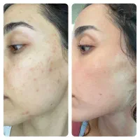 پاکسازی پوست
