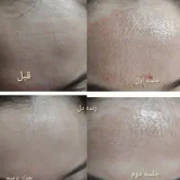 تخفیف روز مادر|آرایشی، بهداشتی، درمانی|مسجد سلیمان, |دیوار