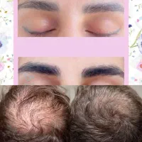 اکسیر رویش مجدد و تقویت مو  نسخه طب سنتی