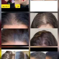 روغن و ا‌کسیر سلامتی|آرایشی، بهداشتی، درمانی|اراک, |دیوار