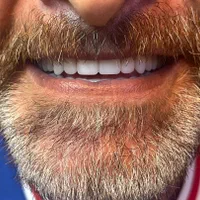 دندانپزشکی و کامپوزیت دندان و دندان مصنوعی|خدمات آرایشگری و زیبایی|تهران, بهداشت|دیوار