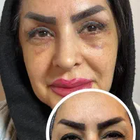 درکلینیک نوتاش با هزینه پایین وکیفیت بالازیبا شوید