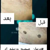 درمان|آرایشی، بهداشتی، درمانی|شهرکرد, |دیوار