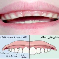 کلینیک نایت گارد دندان مصنوعی متحرک تضمینی|آرایشی، بهداشتی، درمانی|صفادشت, |دیوار