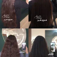 درمان ریزش مو رشد ۴برابری بدون سوزن گارا نتی دار|خدمات زیبایی و سلامت|مشهد, جانباز|دیوار