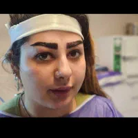 کاشت مو و ابرو در میانه|خدمات آرایشگری و زیبایی|میانه, |دیوار