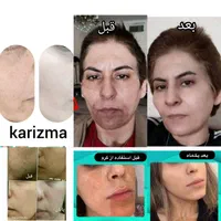 پک سفیدکننده ضدلک فوق حرفه ای کاریزماتیک|آرایشی، بهداشتی، درمانی|شیراز, سیاه سنگ|دیوار