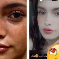 کرم سفید کننده صورت و بدن 10درجه سفیدی دائم