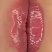 تزریق ژل وبوتاکس|خدمات آرایشگری و زیبایی|شیراز, ریشمک|دیوار