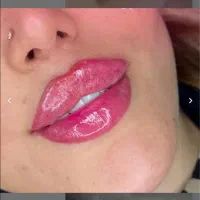 کلینیک پوست زیبایی تزریق ژل390مزوprp لیزر لاغری|خدمات آرایشگری و زیبایی|تهران, ستارخان|دیوار