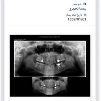 دستیار دندان پزشکی  خانم یا اقا دروازه لاکان
