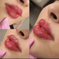 تزریق ژل وبوتاکس وانزیم،لیفت نخ،فیلربادی پلاسما