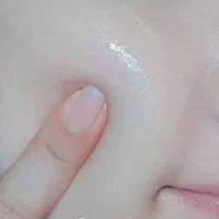 کرم ضد لک و ضد جوش  و سفید کننده  وی ای پی