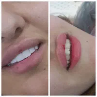 کامپوزیت دندان با بهترین کفیت با قیمتی مناسب|خدمات آرایشگری و زیبایی|یاسوج, |دیوار