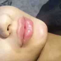 تزریق ژل،بوتاکس درمکانی مستقل بارعایت اصول بهداشتی|خدمات آرایشگری و زیبایی|زاهدان, |دیوار