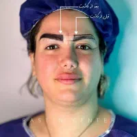 کاشت ابرو با قیمت استثنایی