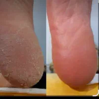 مناسبت روز دختر اسپا و فیشیال دست تخفیف ۵۰ درصد