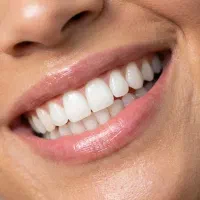 ارتودنسی تخصصی بانوان بدون پیش پرداخت