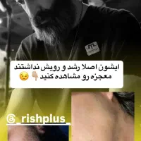 رشد ریش تضمینی|آرایشی، بهداشتی، درمانی|تهران, آبشار|دیوار