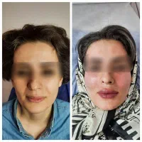 جشنواره یلدایی دکتر نفیسه پور محمدی|خدمات آرایشگری و زیبایی|قم, نیروگاه|دیوار