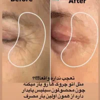 درمان  تمام مشکلات پوستی مو دهان ک دندان|آرایشی، بهداشتی، درمانی|تهران, فرمانیه|دیوار