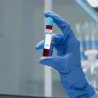 تکنسین آزمایشگاه/نمونه گیری در محیط آزمایشگاه طبی