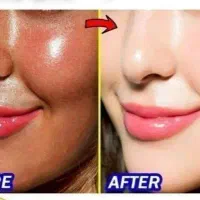 کرم سفید کننده صورت  بدن 10درجه سفیدی بدون بازگشت|آرایشی، بهداشتی، درمانی|زابل, |دیوار