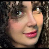 عمل جراحی بینی فقط با ۳۸ تومن با متد پیشرفته|خدمات زیبایی و سلامت|تهران, ونک|دیوار