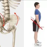 آزادسازی درد سیاتیک واصلاح آن|خدمات آرایشگری و زیبایی|قم, زنبیل آباد|دیوار