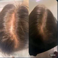 شـ‌امـ‌پو کافئین و جینسینگ