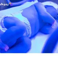 اجاره دستگاه زردی نوزاد (فتوتراپی)|خدمات آرایشگری و زیبایی|اهواز, بهارستان|دیوار