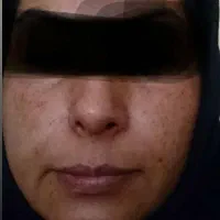 کرم رویال وصابون|آرایشی، بهداشتی، درمانی|لردگان, |دیوار