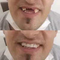 دندون ساز