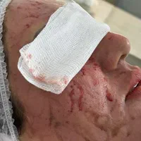 اولین درمانگرلک با متدپکینگ آپ وحذف تک جلسه کک مک|خدمات آرایشگری و زیبایی|بوشهر, |دیوار