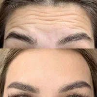 مرکز مجهز زیبایی لیزر تزریق ژل بوتاکس لاغری