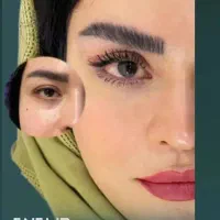 آفر ویژه عمل بینی/آفر ویژه پلک/غبغب/وام فوری