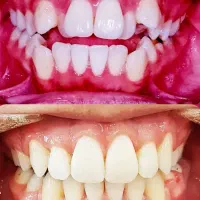 ارتودنسی مشهدتمام اقساط بابهترین متخصص ارتدنس مشهد