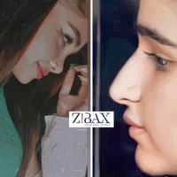 جراحی بینی در شیراز/نوبتگیری  +مشاور