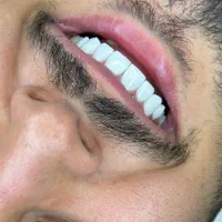 دندانپزشکی با کیفیت بصورت اقساطی|خدمات آرایشگری و زیبایی|شیراز, قدوسی غربی|دیوار