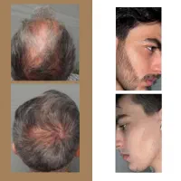 زیبایی و خوشگل بودن رو به خودت تقدیم کن