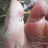 پدیکور و کف سابی کف پا|خدمات آرایشگری و زیبایی|آمل, |دیوار