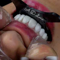 کامپوزیت دندان / دندانسازی / فقط اورجینال