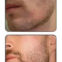 ریش داشته باش تا ریشه دار باشی
