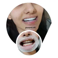 آف ویژه خدمات تخصصی کامپوزیت دندان|خدمات آرایشگری و زیبایی|شاهین‌شهر, فردوسی|دیوار